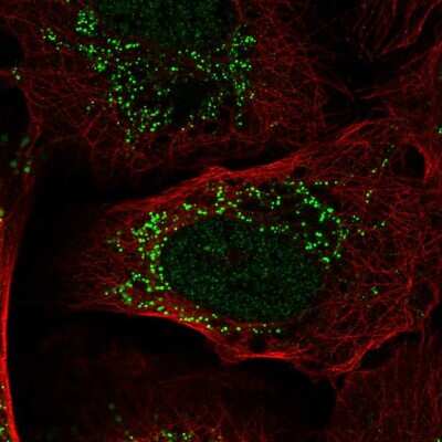 Immunocytochemistry/Immunofluorescence: PIK3R3 Antibody [NBP2-57974] - Staining of human cell line U-2 OS shows localization to nucleoplasm & vesicles.