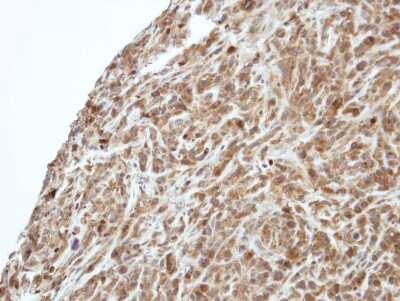 Immunohistochemistry-Paraffin: PIK3R3 Antibody [NBP1-32636] - Paraffin-embedded SAS xenograft, using antibody at 1:500 dilution.