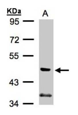 Western Blot: PIK3R3 Antibody [NBP1-32636] - Sample (30ug whole cell lysate)A:A431 7. 5% SDS PAGE, antibody diluted at 1:1000.