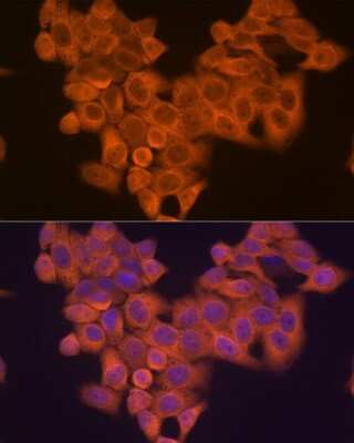 Immunocytochemistry/Immunofluorescence: PIK3R4 Antibody (5J3U5) [NBP3-16612] - Immunofluorescence analysis of HeLa cells using PIK3R4 Rabbit mAb (NBP3-16612) at dilution of 1:100 (40x lens). Blue: DAPI for nuclear staining.