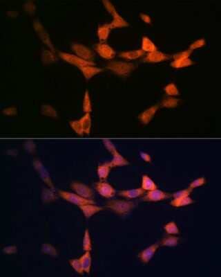 Immunocytochemistry/Immunofluorescence: PIK3R4 Antibody (5J3U5) [NBP3-16612] - Immunofluorescence analysis of NIH-3T3 cells using PIK3R4 Rabbit mAb (NBP3-16612) at dilution of 1:100 (40x lens). Blue: DAPI for nuclear staining.