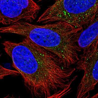 Immunocytochemistry/Immunofluorescence: PIK3R4 Antibody [NBP2-38276] - Immunofluorescent staining of human cell line U-2 OS shows localization to vesicles.