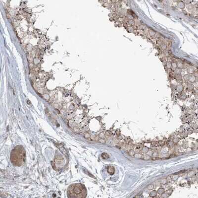 Immunohistochemistry-Paraffin: PIK3R4 Antibody [NBP2-38276] - Staining of human testis shows cytoplasmic positivity in cells in seminiferous ducts and Leydig cells.