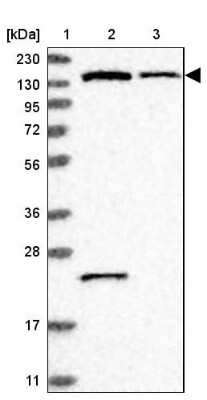 Western Blot: PIK3R4 Antibody [NBP1-82451] - Lane 1: Marker  [kDa] 230, 130, 95, 72, 56, 36, 28, 17, 11.  Lane 2: Human cell line RT-4.  Lane 3: Human cell line U-251MG sp