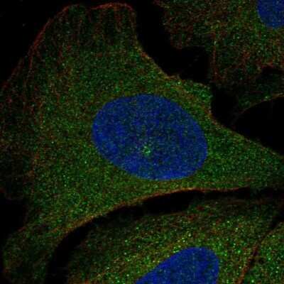 Immunocytochemistry/Immunofluorescence: PIK3R5 Antibody [NBP2-57055] - Staining of human cell line U-2 OS shows localization to cytosol & microtubule organizing center.