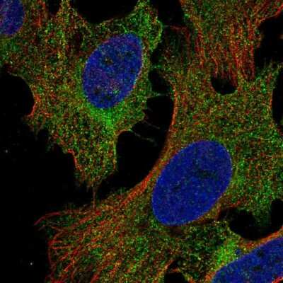 Immunocytochemistry/Immunofluorescence: PIK3R5 Antibody [NBP2-58521] - Staining of human cell line U-2 OS shows localization to cytosol. Antibody staining is shown in green.