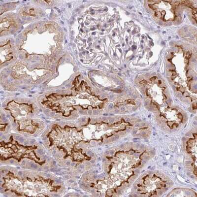 Immunohistochemistry: PIK3R5 Antibody [NBP2-49037] - Staining of human kidney shows strong membranous positivity in cells in tubules.