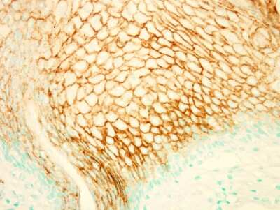Immunohistochemistry-Paraffin: PIK3R5 Antibody [NBP2-19830] - Immunohistochemical staining of FFPE normal human esophagus using anti-PI3K p101 antibody. Nuclei are counterstained with methyl green.