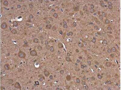 Immunohistochemistry-Paraffin: PIK3R5 Antibody [NBP2-19830] - Sample: Paraffin-embedded rat brain. PIK3R5 kinase p101 antibody C-term diluted at 1:250.