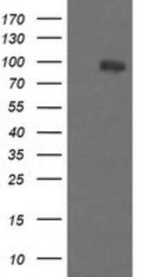 Western Blot: PIK3R5 Antibody (OTI4G9) - Azide and BSA Free [NBP2-73408] - Analysis of HEK293T cells were transfected with the pCMV6-ENTRY control (Left lane) or pCMV6-ENTRY PIK3R5.