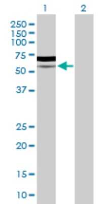 Western Blot: PIK3R5 Antibody [H00023533-D01P] - Analysis of PIK3R5 expression in transfected 293T cell line by PIK3R5 polyclonal antibody.Lane 1: PIK3R5 transfected lysate(54.90 KDa).Lane 2: Non-transfected lysate.