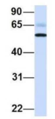 Western Blot: PIK3R5 Antibody [NBP1-56922] - Human Fetal Brain, Antibody Dilution: 1.0 ug/ml.