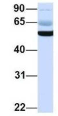 Western Blot: PIK3R5 Antibody [NBP1-56922] - Human Fetal Heart, Antibody Dilution: 1.0 ug/ml.