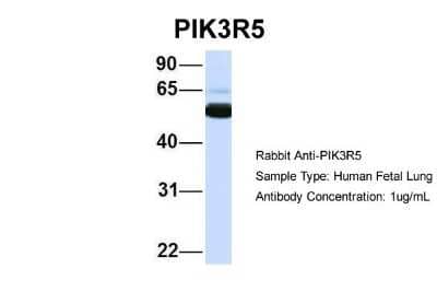 Western Blot: PIK3R5 Antibody [NBP1-56922] - Human Fetal Lung, Antibody Dilution: 1.0 ug/ml.