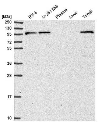 Western Blot: PIK3R5 Antibody [NBP2-57055] - Western blot analysis in human cell line RT-4, human cell line U-251 MG, human plasma, human liver tissue and human tonsil tissue.