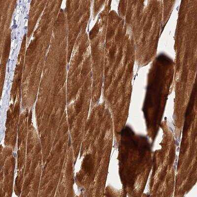 Immunohistochemistry: PIKFyve/PIP5K3 Antibody [NBP1-89613] - Staining of human skeletal muscle shows strong cytoplasmic positivity in myocytes.