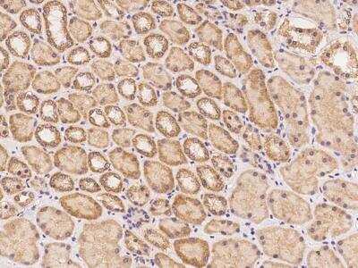 Immunohistochemistry-Paraffin: PIKFyve/PIP5K3 Antibody [NBP3-12608] - Staining of human PIKFYVE in human kidney with rabbit polyclonal antibody at 1:300 dilution.