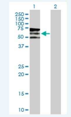 Western Blot: PIKFyve/PIP5K3 Antibody [H00200576-B02P-50ug] -  PIP5K3 expression in transfected 293T cell line (H00200576-T03) by PIP5K3 MaxPab polyclonal antibody.  Lane 1: PIP5K3 transfected lysate(49.61 KDa). Lane 2: Non-transfected lysate.