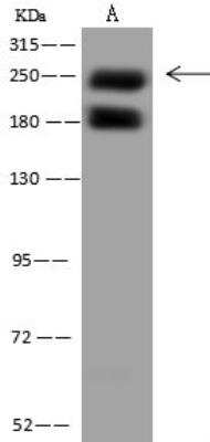 Western Blot: PIKFyve/PIP5K3 Antibody [NBP3-12608] - Lane A: Jurkat Whole Cell LysateLysates/proteins at 30 ug per lane.SecondaryGoat Anti-Rabbit IgG (H+L)/HRP at 1/10000 dilution.Developed using the ECL technique.Performed under reducing conditions.Predicted band size:237 kDaObserved band size:237 kDa(We are unsure as to the identity of these extra bands.)