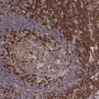 Immunohistochemistry-Paraffin: PILR-alpha Antibody [NBP2-55310] - Staining of human tonsil shows cytoplasmic positivity in both germinal and non-germinal center cells.