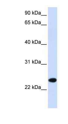 Western Blot: PILRB Antibody [NBP1-62359] - Titration: 0.2-1 ug/ml, Positive Control: Human Muscle.