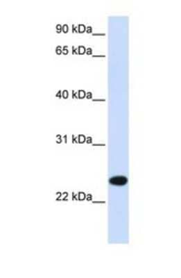 Western Blot: PILRB Antibody [NBP1-69382] - This Anti-PILRB antibody was used in Western Blot of Fetal Muscle tissue lysate at a concentration of 1ug/ml.