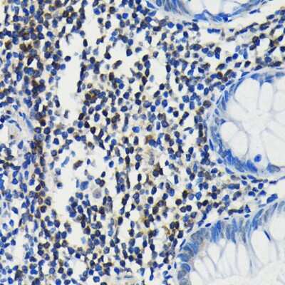 Immunohistochemistry-Paraffin: PIM1 Antibody (4C8D0) [NBP3-15863] - Immunohistochemistry of paraffin-embedded human colon using PIM1 antibody (NBP3-15863) at dilution of 1:100 (40x lens).Perform microwave antigen retrieval with 10 mM PBS buffer pH 7.2 before commencing with IHC staining protocol.