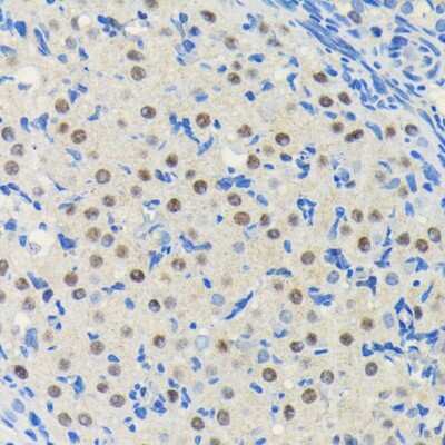 Immunohistochemistry-Paraffin: PIM1 Antibody (4C8D0) [NBP3-15863] - Immunohistochemistry of paraffin-embedded rat ovary using PIM1 antibody (NBP3-15863) at dilution of 1:100 (40x lens).Perform microwave antigen retrieval with 10 mM PBS buffer pH 7.2 before commencing with IHC staining protocol.