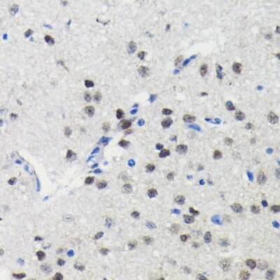 Immunohistochemistry-Paraffin: PIM1 Antibody (4C8D0) [NBP3-15863] - Immunohistochemistry of paraffin-embedded mouse brain using PIM1 antibody (NBP3-15863) at dilution of 1:100 (40x lens).Perform microwave antigen retrieval with 10 mM PBS buffer pH 7.2 before commencing with IHC staining protocol.