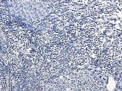 Immunohistochemistry-Paraffin: PIM1 Antibody (S08-8D5) [NBP3-14963] - Immunohistochemistry of PIM1 in paraffin-embedded Human tonsil using PIM1 Rabbit mAb at dilution 1/50