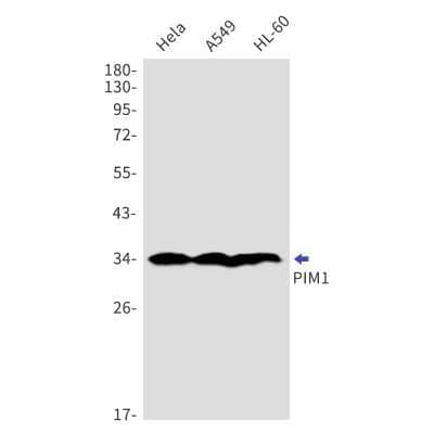 Western Blot: PIM1 Antibody (S08-8D5) [NBP3-14963] - Western blot detection of PIM1 in Hela, A549, HL-60 cell lysates using PIM1 Rabbit mAb (1:1000 diluted). Predicted band size: 45kDa. Observed band size: 34kDa.