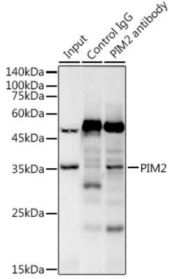 Immunoprecipitation: PIM2 Antibody (3V1S5) [NBP3-16789] - Immunoprecipitation analysis of 300ug extracts of Raji cells using 3ug PIM2 antibody (NBP3-16789). Western blot was performed from the immunoprecipitate using PIM2 antibody (NBP3-16789) at a dilition of 1:1000.