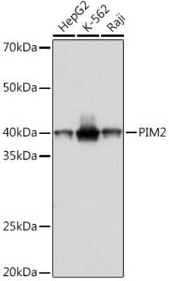 Western Blot: PIM2 Antibody (3V1S5) [NBP3-16789] - Western blot analysis of extracts of various cell lines, using PIM2 Rabbit mAb (NBP3-16789) at 1:1000 dilution. Secondary antibody: HRP Goat Anti-Rabbit IgG (H+L) at 1:10000 dilution. Lysates/proteins: 25ug per lane. Blocking buffer: 3% nonfat dry milk in TBST. Detection: ECL Basic Kit. Exposure time: 1s.