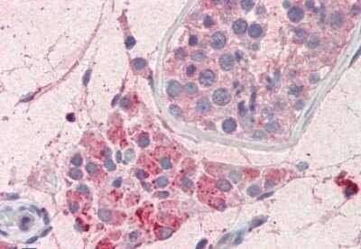 Immunohistochemistry-Paraffin: PIM2 Antibody [NBP2-26114] - 5ug/ml staining of paraffin embedded Human Testis. Steamed antigen retrieval with citrate buffer pH 6, AP-staining.