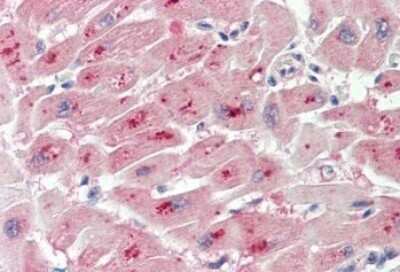 Immunohistochemistry-Paraffin: PIM2 Antibody [NBP2-26115] - 5ug/ml staining of paraffin embedded Human Heart. Steamed antigen retrieval with citrate buffer pH 6, AP-staining.