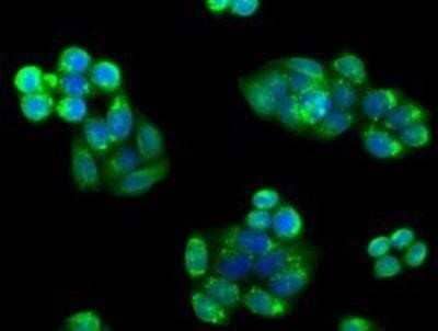 Immunocytochemistry/Immunofluorescence: PIM2 Antibody (OTI5D5) - Azide and BSA Free [NBP2-73412] - Staining of HeLa cells using anti-PIM2 mouse monoclonal antibody.