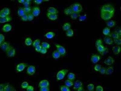 Immunocytochemistry/Immunofluorescence: PIM2 Antibody (OTI5D5) - Azide and BSA Free [NBP2-73412] - Staining of HT29 cells using anti-PIM2 mouse monoclonal antibody.