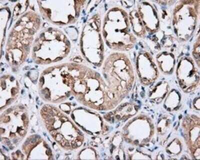 Immunohistochemistry: PIM2 Antibody (OTI5D5) - Azide and BSA Free [NBP2-73412] - Staining of paraffin-embedded Human Kidney tissue using anti-PIM2 mouse monoclonal antibody.