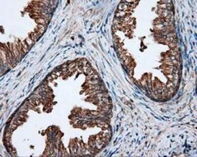 Immunohistochemistry: PIM2 Antibody (OTI5D5) - Azide and BSA Free [NBP2-73412] - Staining of paraffin-embedded Human prostate tissue using anti-PIM2 mouse monoclonal antibody.