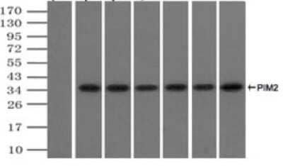 Immunoprecipitation: PIM2 Antibody (OTI5D5) - Azide and BSA Free [NBP2-73412] - (Negative control: IP without adding anti-PIM2 antibody.). For each experiment, 500ul of DDK tagged PIM2 overexpression lysates (at 1:5 dilution with HEK293T lysate), 2ug of anti-PIM2 antibody and 20ul (0.1mg) of goat anti-mouse conjugated magnetic beads were mixed and incubated overnight. After extensive wash to remove any non-specific binding, the immuno-precipitated products were analyzed with rabbit anti-DDK polyclonal antibody.