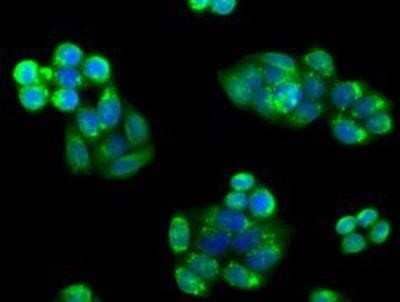 Immunocytochemistry/Immunofluorescence: PIM2 Antibody (OTI5D5) [NBP2-02441] - Immunofluorescent staining of HeLa cells using anti-PIM2 mouse monoclonal antibody.