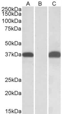 Western Blot: PIM2 Antibody [NBP2-26115] - HEK293 lysate (10 ug protein in RIPA buffer) overexpressing Human PIM2 with C-terminal MYC tag probed with NBP2-26115 (0.1 ug/ml) in Lane A and probed with anti-MYC Tag (1/1000) in lane C. Mock-transfected HEK293 probed with NBP2-26115 (0.1 mg/ml) in Lane B. Primary incubations were for 1 hour. Detected by chemiluminescence.