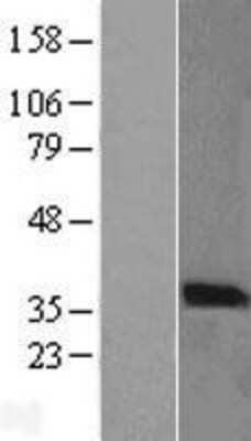 Western Blot PIM2 Overexpression Lysate