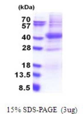 SDS-PAGE Recombinant Human PIM2 His Protein