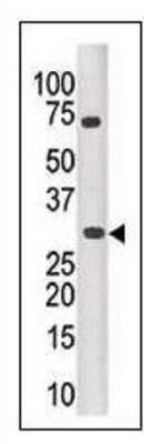 Western Blot: PIM3 Antibody [NBP1-50553] - Analysis of anti-PIM3 antibody with mouse kidney tissue lysate.