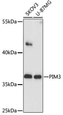 Western Blot: PIM3 Antibody [NBP2-93244] - Analysis of extracts of various cells, using PIM3 at 1:1000 dilution. Secondary antibody: HRP Goat Anti-Rabbit IgG (H+L) at 1:10000 dilution. Lysates/proteins: 25ug per lane. Blocking buffer: 3% nonfat dry milk in TBST. Detection: ECL Basic Kit . Exposure time: 90s.