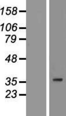 Western Blot: PIM3 Overexpression Lysate (Adult Normal) [NBP2-08960] Left-Empty vector transfected control cell lysate (HEK293 cell lysate); Right -Over-expression Lysate for PIM3.