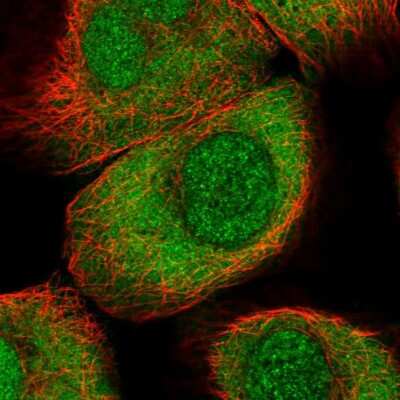 Immunocytochemistry/Immunofluorescence: PIMT Antibody [NBP1-92271] - Staining of human cell line A-431 shows localization to nucleus & cytosol. Antibody staining is shown in green.