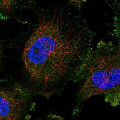 Immunocytochemistry/Immunofluorescence: PIMT Antibody [NBP2-56790] - Staining of human cell line U-251 MG shows localization to cytosol.