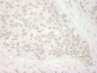 Immunohistochemistry-Paraffin PIMT Antibody